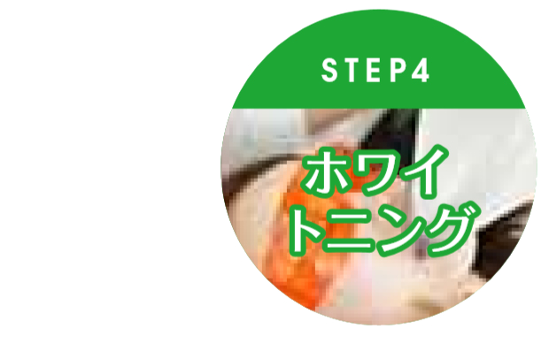 STEP4 ホワイトニング